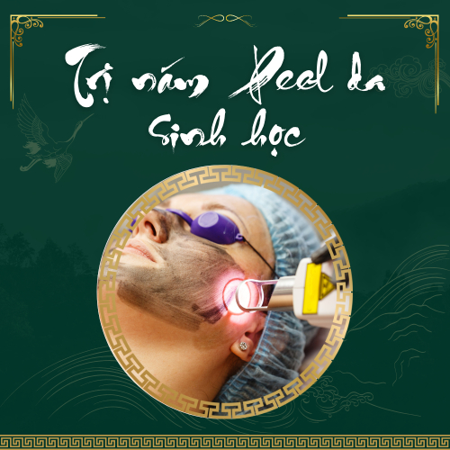 Trị Nám Peel Da Sinh Học